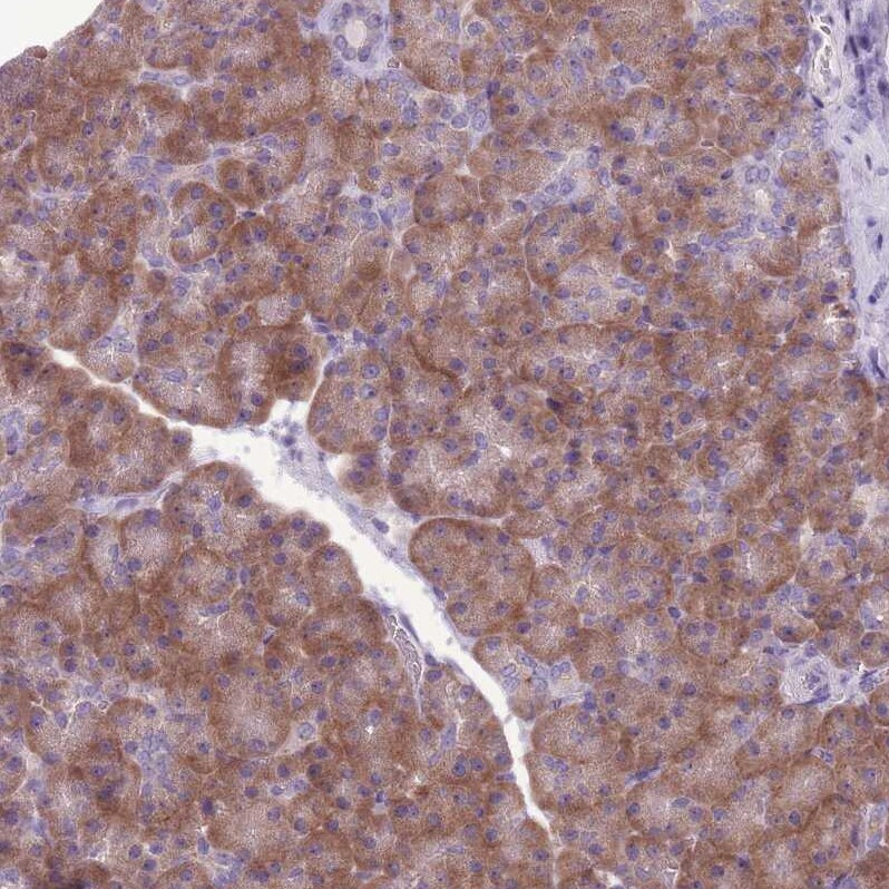 RPS11 Antibody - BSA Free Immunohistochemistry: RPS11 Antibody - BSA Free [NBP2-13262]