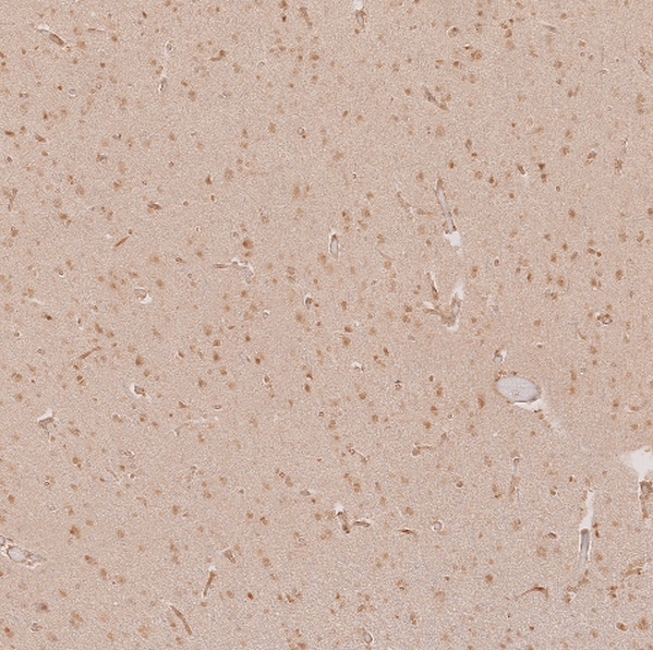 SALL1 Antibody - BSA Free Immunohistochemistry: SALL1 Antibody - BSA Free [NBP2-13275]