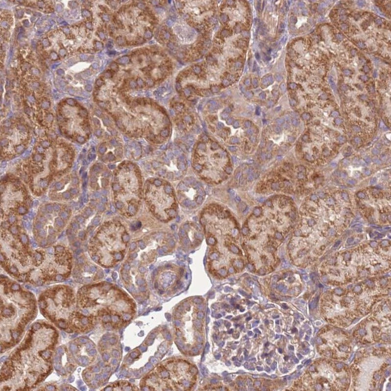 SCARA3 Antibody - BSA Free Immunohistochemistry: SCARA3 Antibody - BSA Free [NBP2-13286]