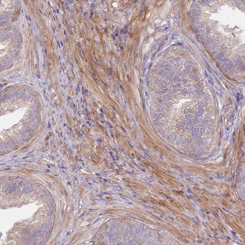 SCARA3 Antibody - BSA Free Immunohistochemistry: SCARA3 Antibody - BSA Free [NBP2-13286]