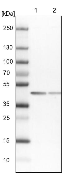 SCARA3 Antibody - BSA Free Western Blot: SCARA3 Antibody - BSA Free [NBP2-13286]