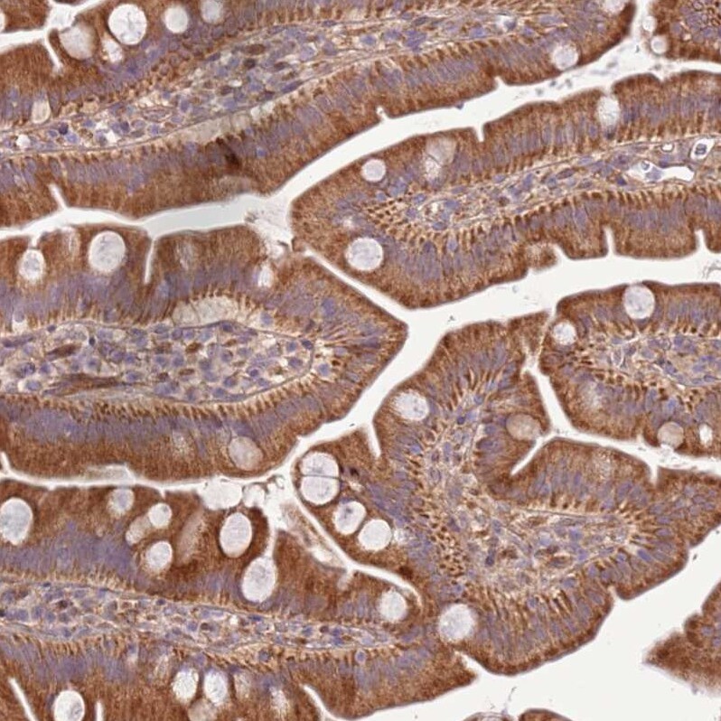 SCARA3 Antibody - BSA Free Immunohistochemistry: SCARA3 Antibody - BSA Free [NBP2-13286]