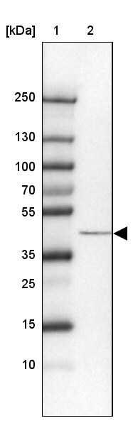 SCCPDH Antibody - BSA Free Western Blot: SCCPDH Antibody - BSA Free [NBP2-13287]