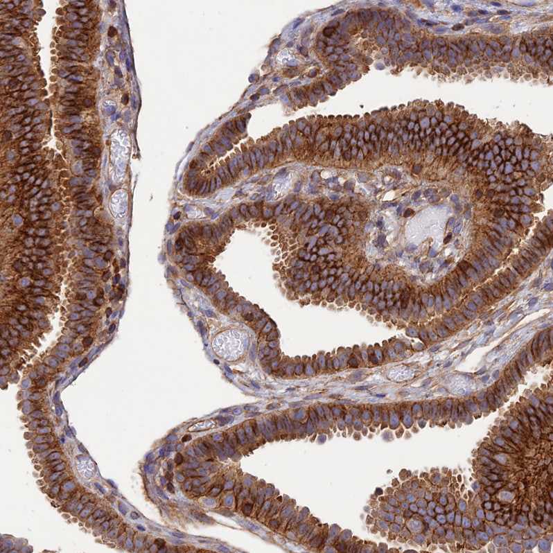 Septin-9 Antibody - BSA Free Immunohistochemistry: Septin-9 Antibody - BSA Free [NBP2-13294]