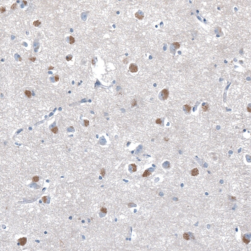 SERINC3 Antibody - BSA Free Immunohistochemistry: SERINC3 Antibody - BSA Free [NBP2-13296]