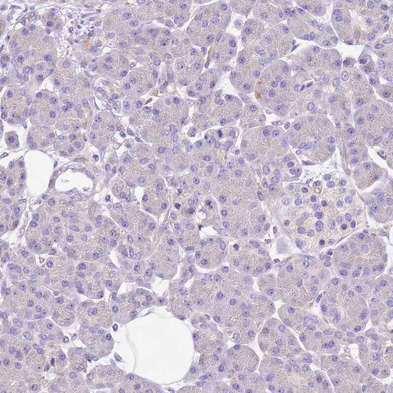 SERINC3 Antibody - BSA Free Immunohistochemistry: SERINC3 Antibody - BSA Free [NBP2-13296]