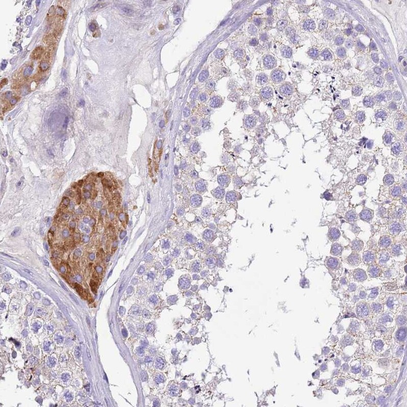 SERINC3 Antibody - BSA Free Immunohistochemistry: SERINC3 Antibody - BSA Free [NBP2-13296]