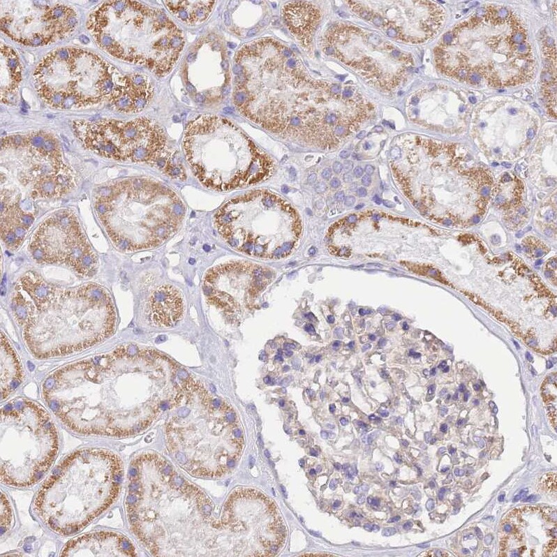 SERINC3 Antibody - BSA Free Immunohistochemistry: SERINC3 Antibody - BSA Free [NBP2-13296]