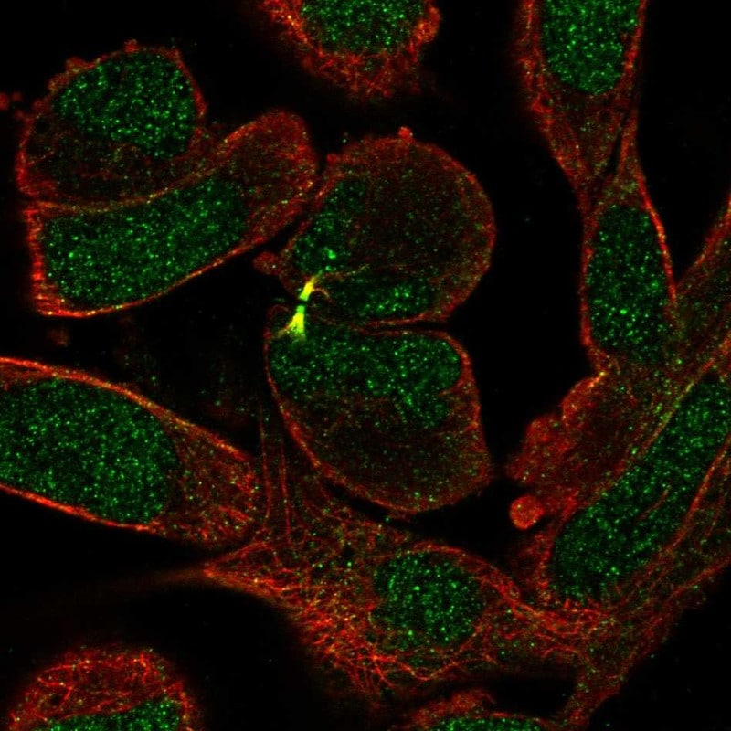Senataxin Antibody - BSA Free Immunocytochemistry/ Immunofluorescence: Senataxin Antibody [NBP2-13300]