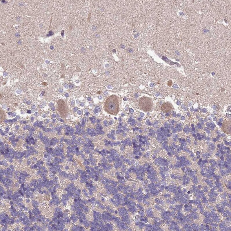 Senataxin Antibody - BSA Free Immunohistochemistry: Senataxin Antibody - BSA Free [NBP2-13300]
