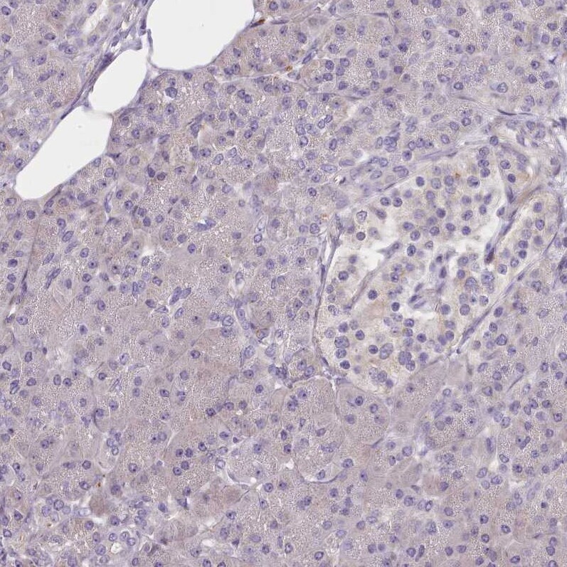Senataxin Antibody - BSA Free Immunohistochemistry: Senataxin Antibody - BSA Free [NBP2-13300]