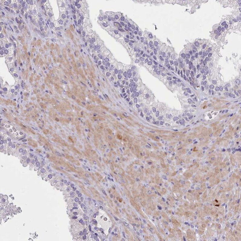 Senataxin Antibody - BSA Free Immunohistochemistry: Senataxin Antibody - BSA Free [NBP2-13300]