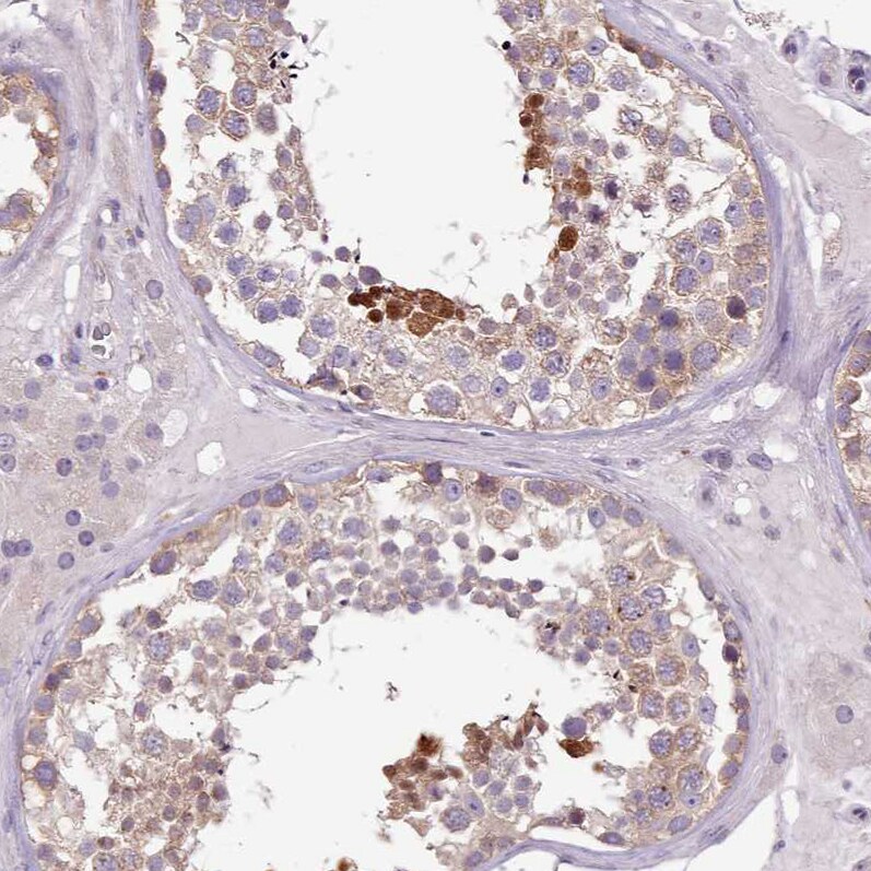 Senataxin Antibody - BSA Free Immunohistochemistry: Senataxin Antibody - BSA Free [NBP2-13300]