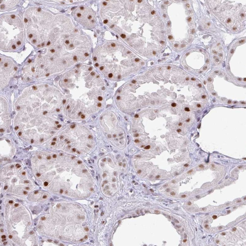 SF3B5 Antibody - BSA Free Immunohistochemistry: SF3B5 Antibody - BSA Free [NBP2-13301]