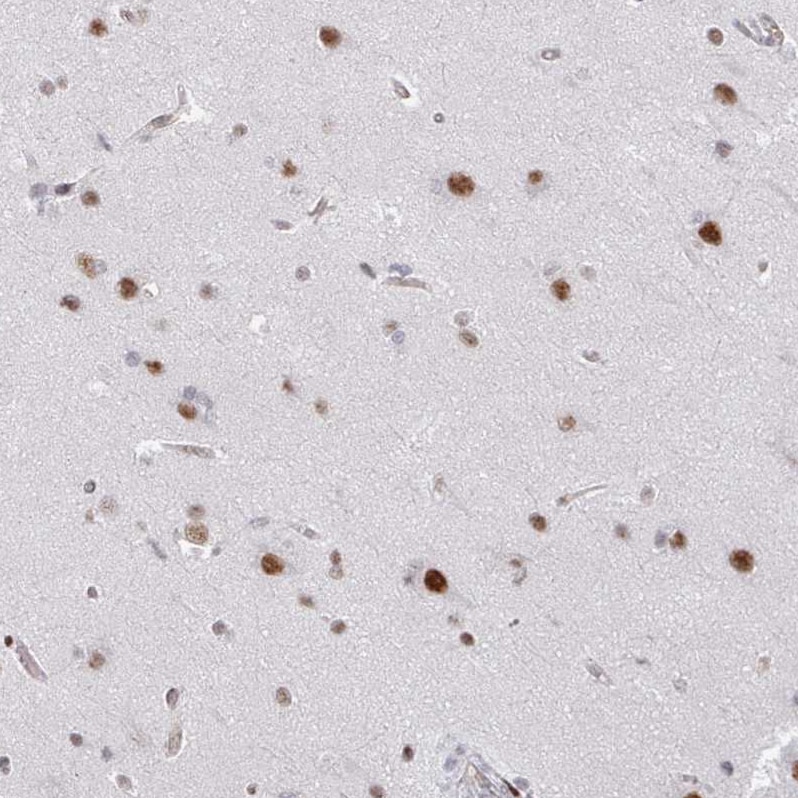 SF3B5 Antibody - BSA Free Immunohistochemistry: SF3B5 Antibody - BSA Free [NBP2-13301]