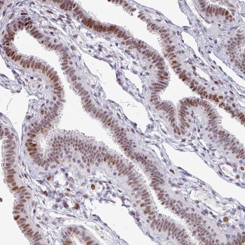 SF3B5 Antibody - BSA Free Immunohistochemistry: SF3B5 Antibody - BSA Free [NBP2-13301]
