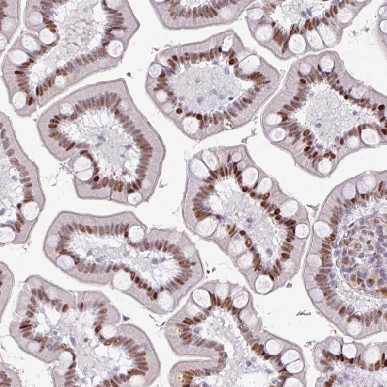 SF3B5 Antibody - BSA Free Immunohistochemistry: SF3B5 Antibody - BSA Free [NBP2-13301]