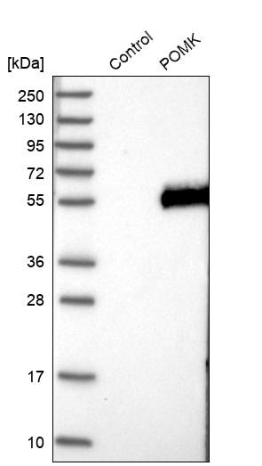 POMK/SGK196 Antibody - BSA Free Western Blot: POMK/SGK196 Antibody - BSA Free [NBP2-13302]