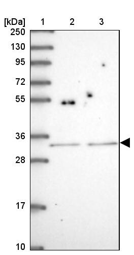 SH2B2 Antibody - BSA Free Western Blot: SH2B2 Antibody - BSA Free [NBP2-13305]