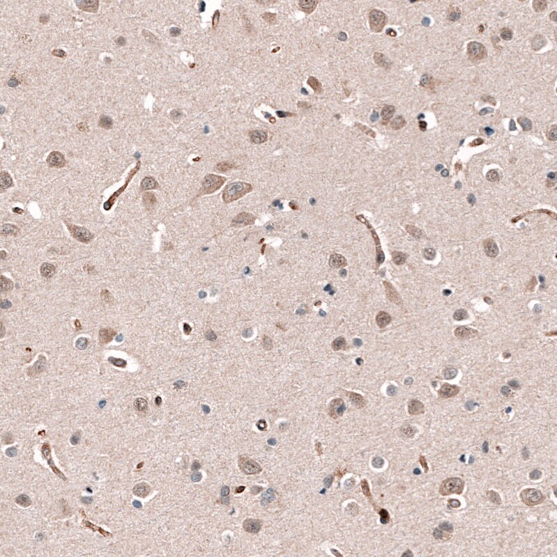 SHC3 Antibody - BSA Free Immunohistochemistry: SHC3 Antibody - BSA Free [NBP2-13307]