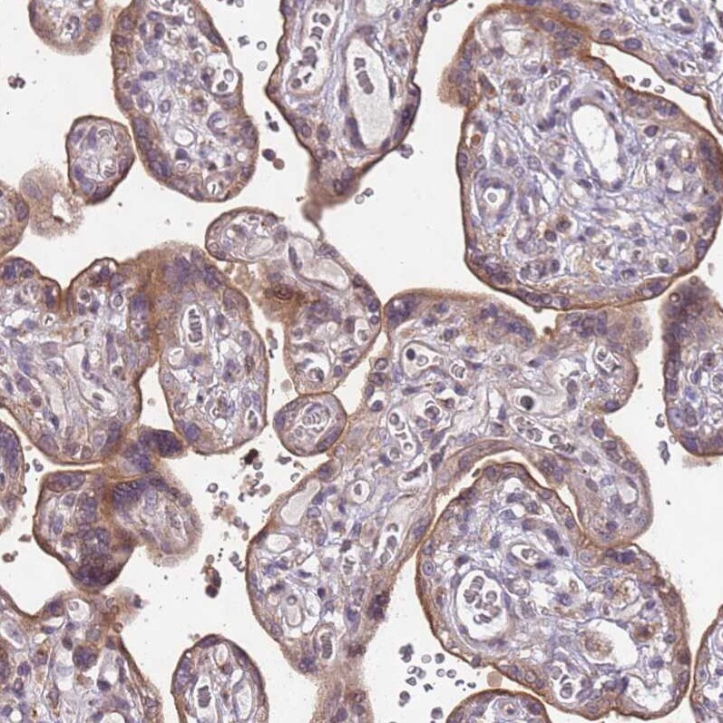 SLC16A4 Antibody - BSA Free Immunohistochemistry: SLC16A4 Antibody - BSA Free [NBP2-13315]
