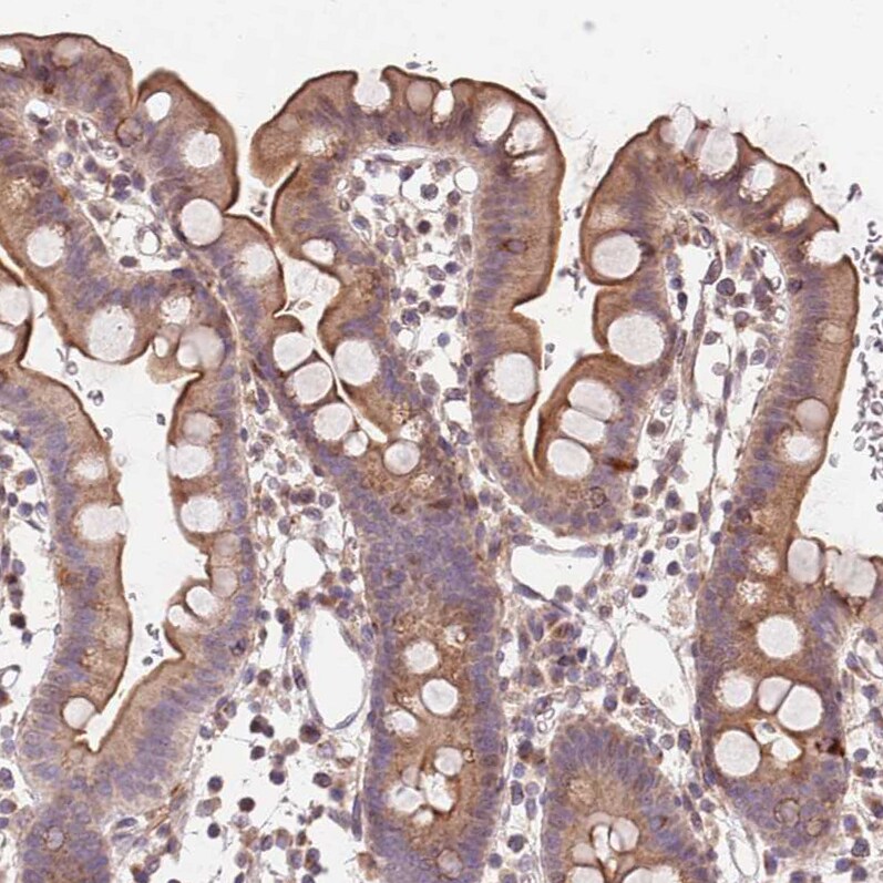 SLC16A4 Antibody - BSA Free Immunohistochemistry: SLC16A4 Antibody - BSA Free [NBP2-13315]