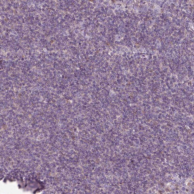 SLC1A7 Antibody - BSA Free Immunohistochemistry: SLC1A7 Antibody - BSA Free [NBP2-13317]