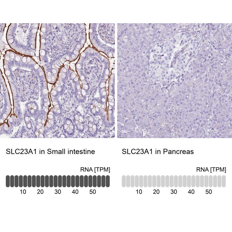 SLC23A1 Antibody - BSA Free Immunohistochemistry: SLC23A1 Antibody - BSA Free [NBP2-13318]