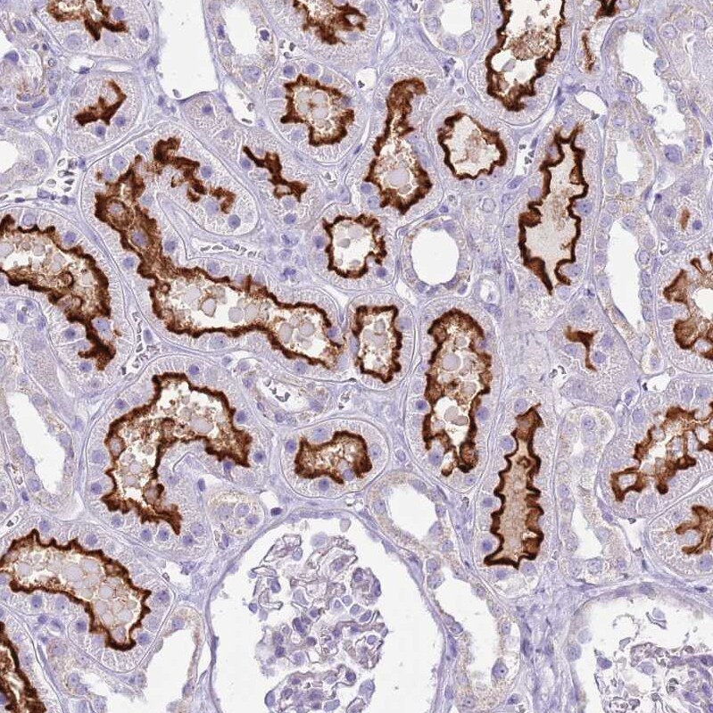 SLC23A1 Antibody - BSA Free Immunohistochemistry: SLC23A1 Antibody - BSA Free [NBP2-13318]