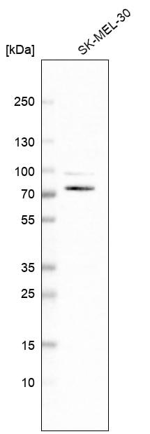SLC23A2 Antibody Western Blot: SLC23A2 Antibody [SLC23A2 Antibody]