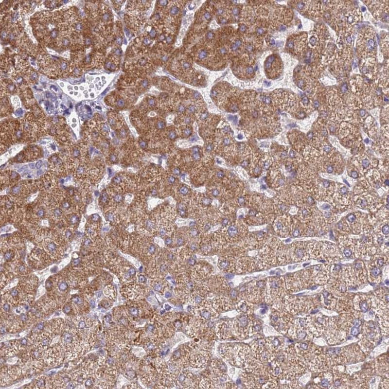 SLC25A15 Antibody - BSA Free Immunohistochemistry: SLC25A15 Antibody - BSA Free [NBP2-13320]