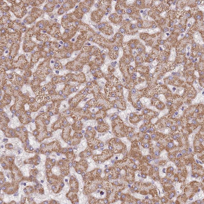 SLC25A42 Antibody - BSA Free Immunohistochemistry: SLC25A42 Antibody - BSA Free [NBP2-13325]