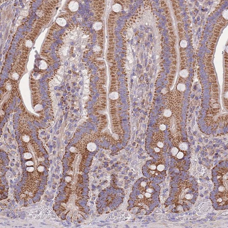 SLC25A42 Antibody - BSA Free Immunohistochemistry: SLC25A42 Antibody - BSA Free [NBP2-13325]