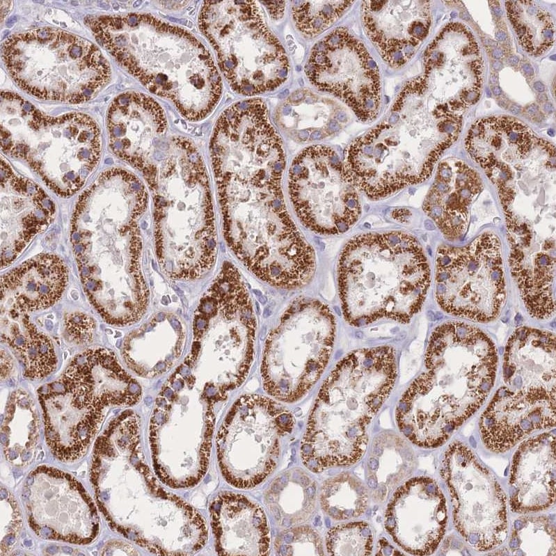 SLC25A42 Antibody - BSA Free Immunohistochemistry: SLC25A42 Antibody - BSA Free [NBP2-13325]