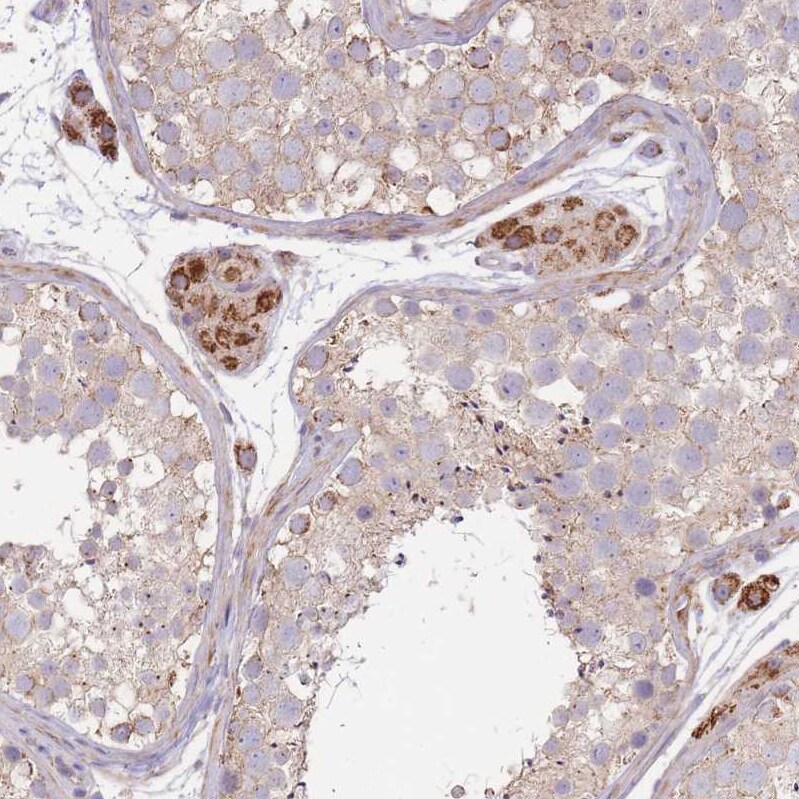 SLC25A42 Antibody - BSA Free Immunohistochemistry: SLC25A42 Antibody - BSA Free [NBP2-13325]