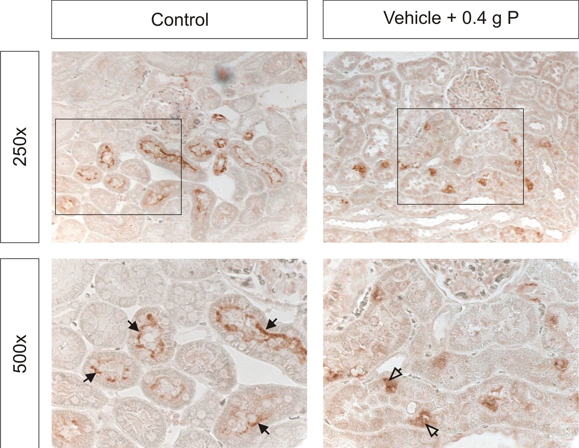 SLC34A1 Antibody