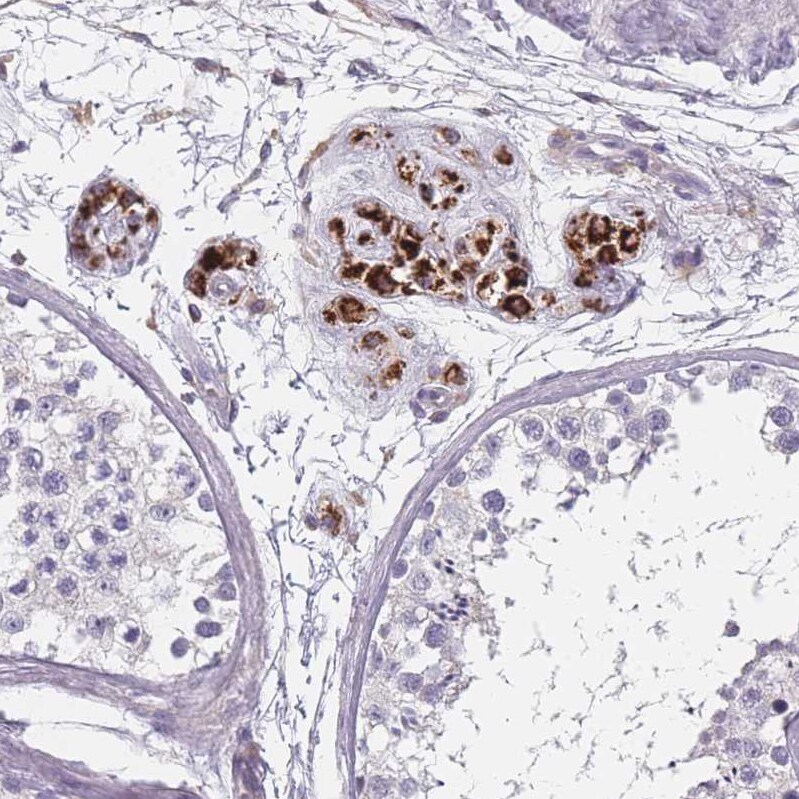 SLC35E4 Antibody - BSA Free Immunohistochemistry: SLC35E4 Antibody - BSA Free [NBP2-13330]
