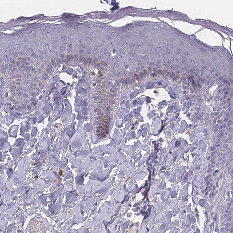 SLC35E4 Antibody - BSA Free Immunohistochemistry: SLC35E4 Antibody - BSA Free [NBP2-13330]