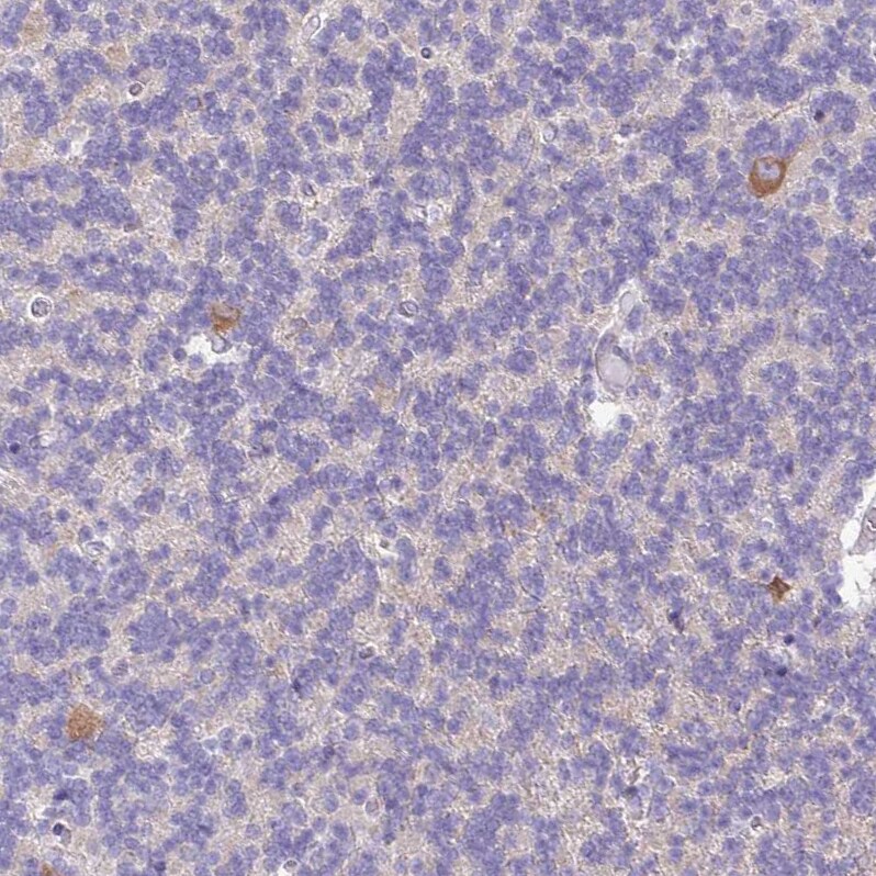 SLC38A1 Antibody - BSA Free Immunohistochemistry: SLC38A1 Antibody - BSA Free [NBP2-13336]