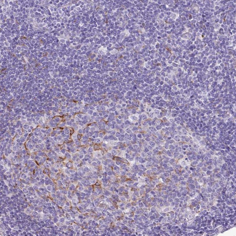 SLC38A1 Antibody - BSA Free Immunohistochemistry: SLC38A1 Antibody - BSA Free [NBP2-13336]