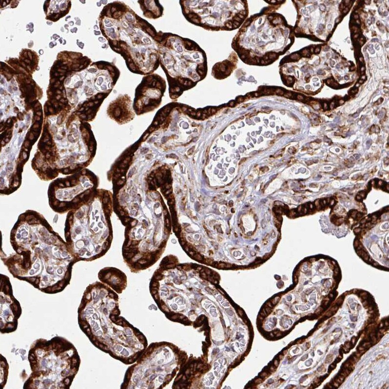 SLC39A7/ZIP7 Antibody - BSA Free Immunohistochemistry: SLC39A7/ZIP7 Antibody - BSA Free [NBP2-13338]
