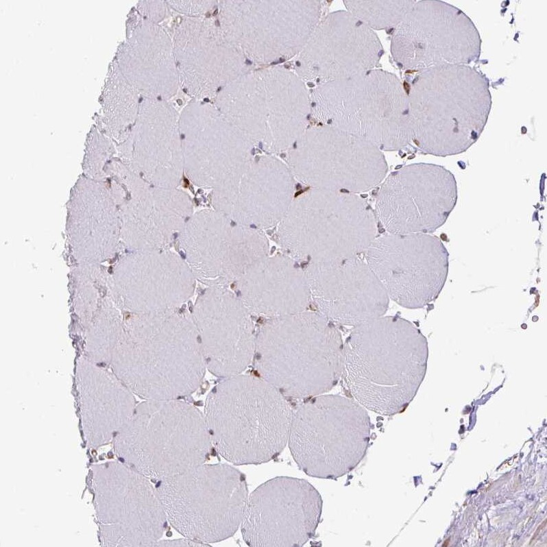 SLC39A7/ZIP7 Antibody - BSA Free Immunohistochemistry: SLC39A7/ZIP7 Antibody - BSA Free [NBP2-13338]