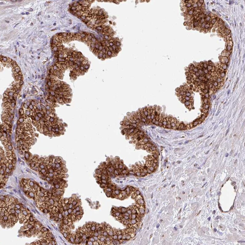 SLC39A7/ZIP7 Antibody - BSA Free Immunohistochemistry: SLC39A7/ZIP7 Antibody - BSA Free [NBP2-13338]