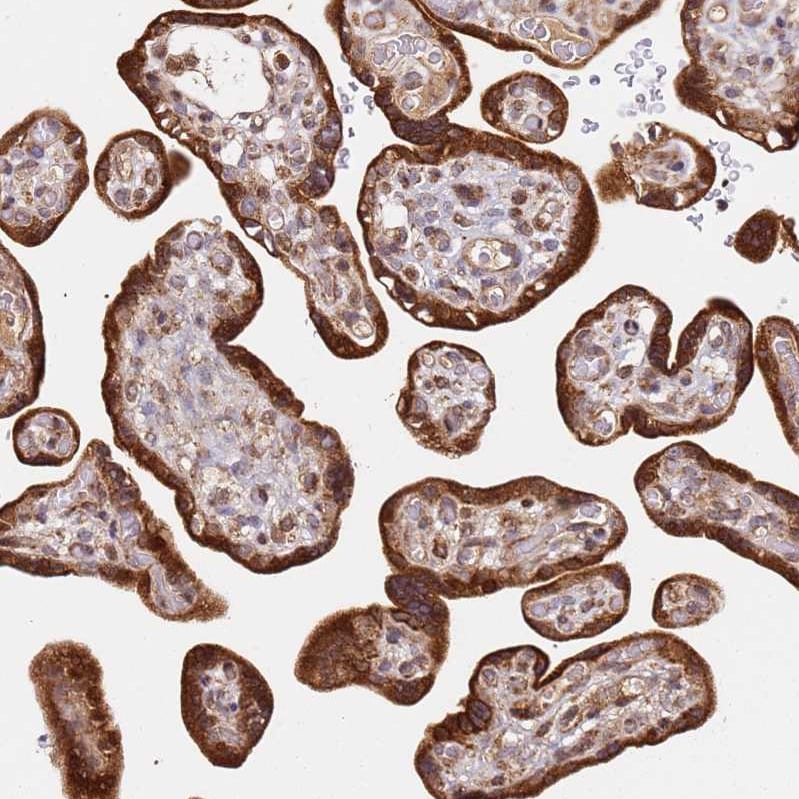 SMOX Antibody - BSA Free Immunohistochemistry: SMOX Antibody - BSA Free [NBP2-13356]