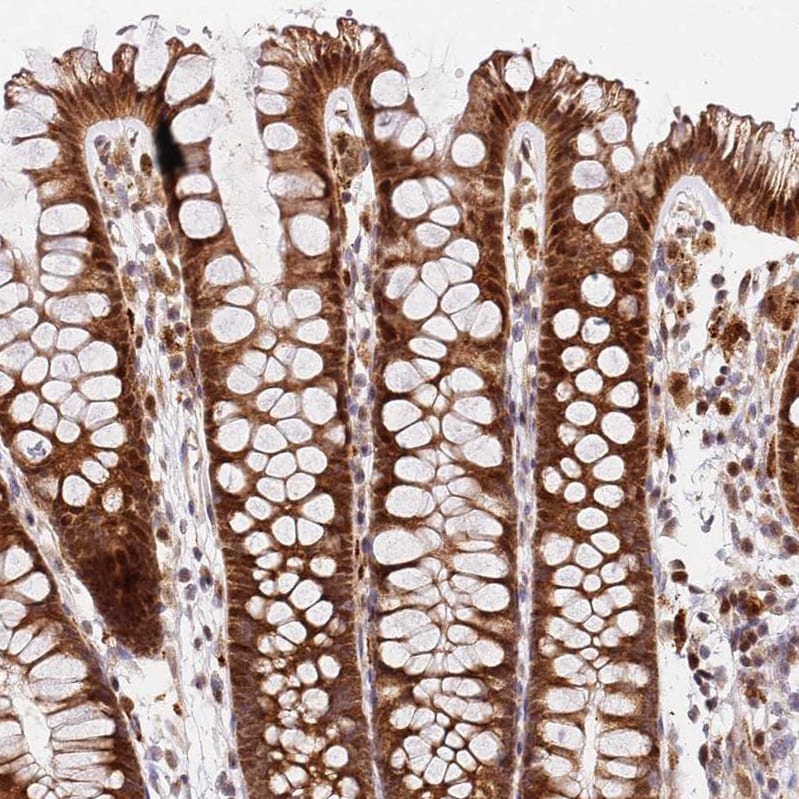 SMOX Antibody - BSA Free Immunohistochemistry: SMOX Antibody - BSA Free [NBP2-13356]