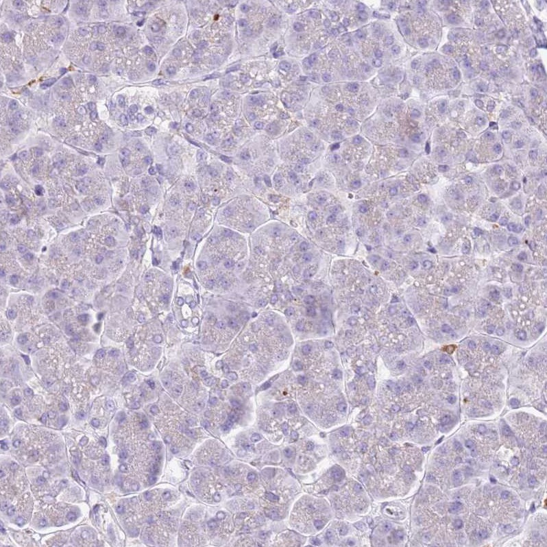 Snx6 Antibody - BSA Free Immunohistochemistry: Snx6 Antibody - BSA Free [NBP2-13361]