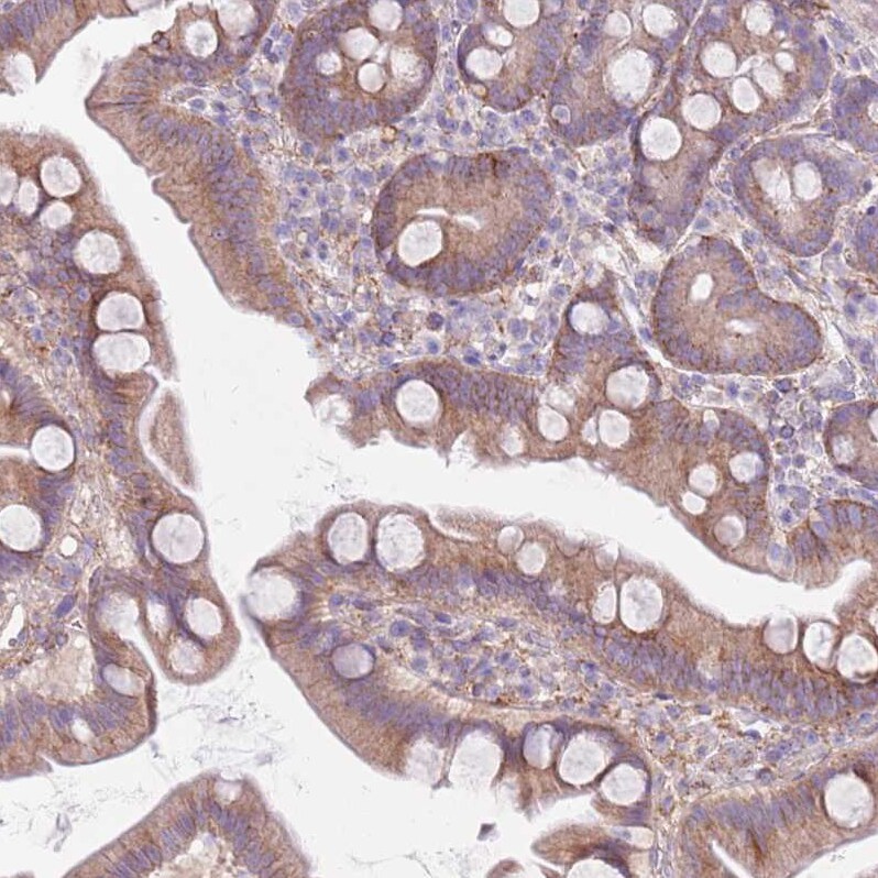 Snx6 Antibody - BSA Free Immunohistochemistry: Snx6 Antibody - BSA Free [NBP2-13361]