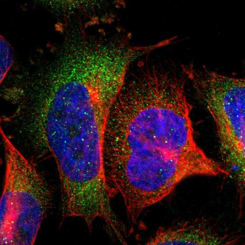 SOCS-7/Nck/NAP4 Antibody - BSA Free Immunocytochemistry/ Immunofluorescence: SOCS-7/Nck/NAP4 Antibody [NBP2-13363]
