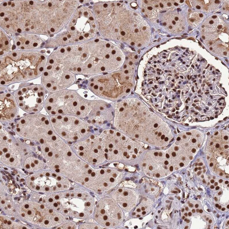 ARS2 Antibody - BSA Free Immunohistochemistry: ARS2 Antibody - BSA Free [NBP2-13382]