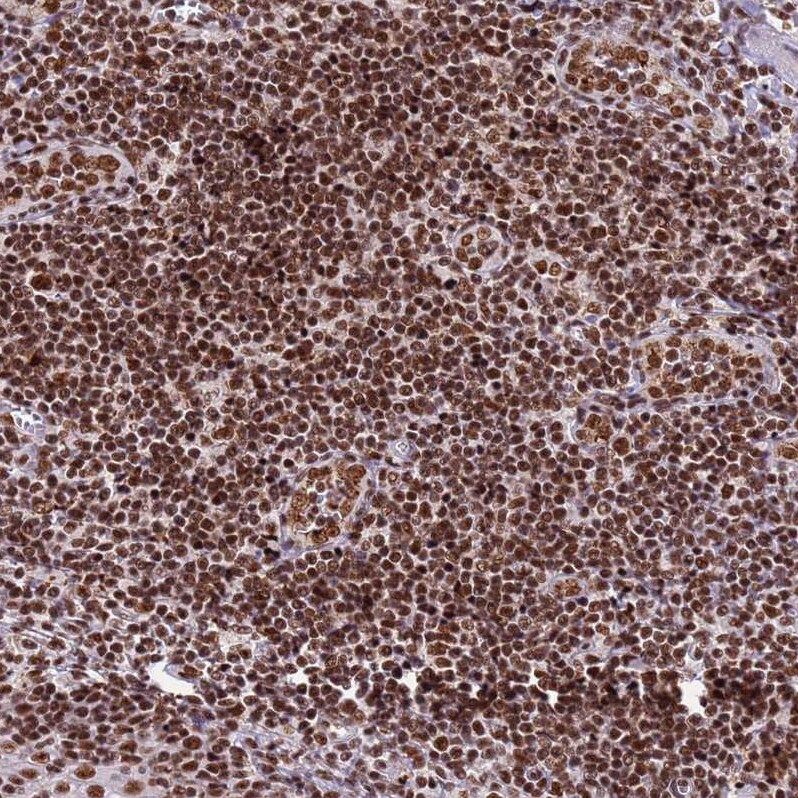 ARS2 Antibody - BSA Free Immunohistochemistry: ARS2 Antibody - BSA Free [NBP2-13382]